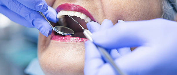 Best Dental Abscess Treatment in Hoquiam, WA